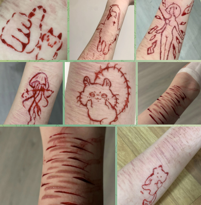 seni melukai diri sendiri (self-harm art)