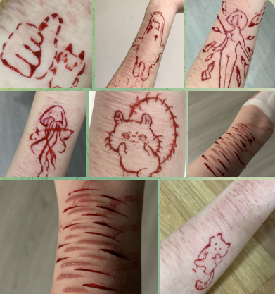 seni melukai diri sendiri (self-harm art)